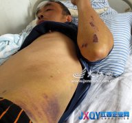 工人摔傷后雇主避而不見 南昌加迪豪鋁業(yè)有限公